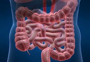 Ischemic Colitis, Radang Pada Usus Besar