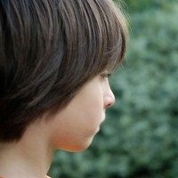 Angelman Syndrome, Sebabkan Masalah Neurologis