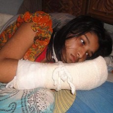 Sadis! Suami Tega Potong 5 Jari Tangan Istri karena Kuliah Tanpa Izin