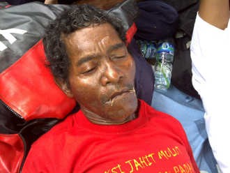 Hari Kedua, Ada 18 Warga Kepulauan Meranti Jahit Mulut di DPR