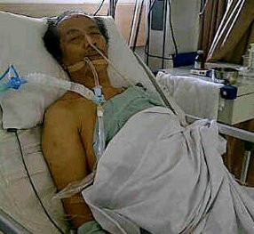 Menderita Diabetes, Aom Kusman Masih Dirawat di ICU