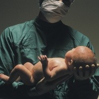 Salah Diagnosis, Bayi Baru Lahir Dikira Mati
