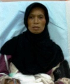 Kena TBC & Gizi Buruk, TKW Jamilah Dirawat di RS King Faisal Makkah