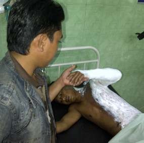 Ledakan di Pabrik Rambut Palsu Diduga Akibat Mesin Pompa Macet