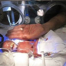 Bayi Termungil Ketiga di Dunia Lahir di AS
