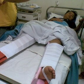 Panpel Persib Tanggung Biaya Operasi Ikhsan