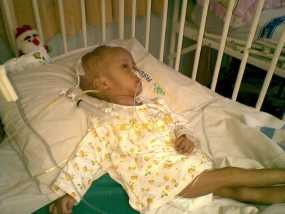 Tolong! Annisa Penderita Hydrocephalus & Sindrom Down Butuh Bantuan