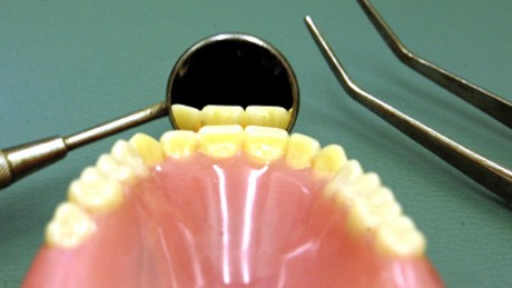 Wanita AS Nekat Rampok Bank Demi Beli Gigi Palsu