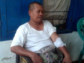 Sejumlah Desa di Sidoarjo Diteror Kera, 23 Orang Diserang dan Digigit