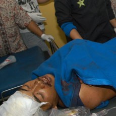 9 Jam Setelah Kecelakaan Maut, Cisarua Arah Jakarta Macet Total