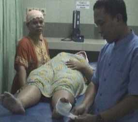 Ibu Hamil 2 Bulan Jadi Korban Gigitan Kera