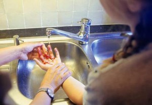 Gangguan Jiwa, Belum Berhenti Cuci Tangan Kalau Belum Berdarah