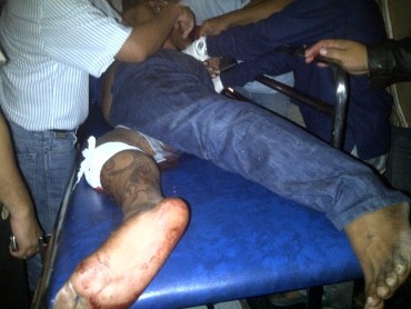 Tiba di RS Polri, John Kei Langsung Dirontgen 