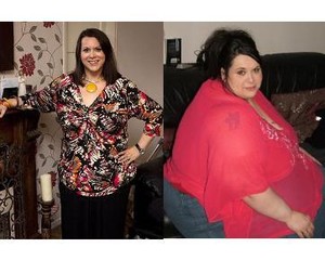Wanita Super Gemuk Sukses Turunkan Berat Badan 191 Kg