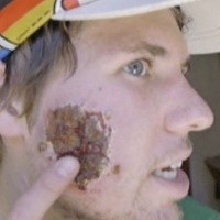 Wajah Tampan Jadi Mengerikan Karena Digerogoti Parasit