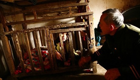 Mengenaskan! Pemuda Ini Dikurung dalam Kandang Selama 21 Tahun