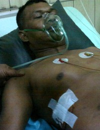 Korban mengalami luka tembak pada bagian pinggang. ANTARA/Heru Dwi S.