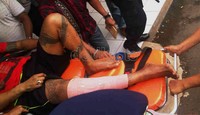 John mengenakan baju kaos oranye dan celana pendek. Kakinya yang terkena luka tembak masih dibalut perban. Dhurandhara/detikcom.