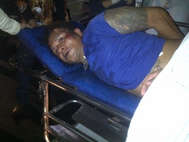 Istri: Luka John Kei Cukup Parah