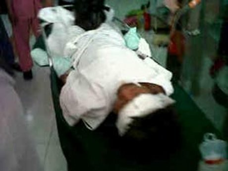 Tangan Dua Korban Bom Pipa Semarang Hancur