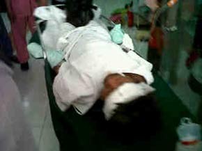 Dwi, Korban Bom Pipa Semarang Kritis