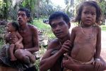 Hutan Dijarah, Anak Rimba Kekurangan Gizi