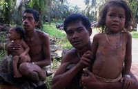 Buruknya gizi dikelompok ini bisa jadi disebabkan semakin sulitnya mendapatkan sumber pangan, ditambah sulitnya akses mereka ke pusat-pusat pelayanan kesehatan umum. (dok. LSM Warsi)