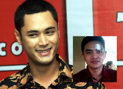 Minta Damai, Panji Trihatmodjo Intervensi Korban Pelemparan Gelas?