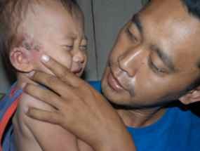 Meluas, Serangga Tomcat Merambah Situbondo