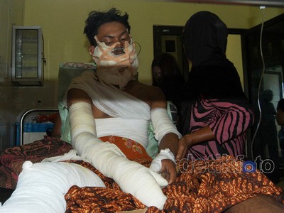 Motor Tabrak Kios Bensin, 2 Warga Terbakar