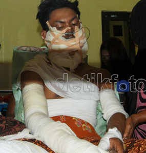 Tabrak Kios Bensin, Seorang Biker & Penambal Ban Hangus Terbakar