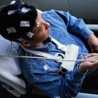 Ini Dia yang Bikin Serangan Epilepsi Kambuh