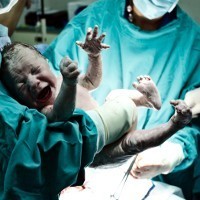 Cegah Caesar yang Tak Perlu, Dunia Bisa Hemat Hingga Rp 21 M