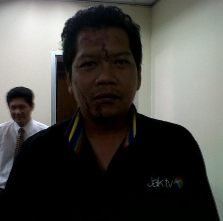 Kamerawan JakTV yang Kena Cairan Kimia Diterima Dewan Pers