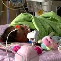 Bayi Berjuang Hidup Karena Lahir dengan Jantung Separuh