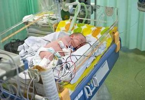 63 Tenaga Medis Berjuang Demi Selamatkan 1 Bayi dari Demam Aneh
