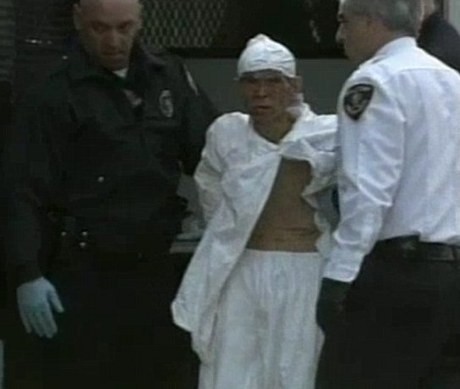 Sadis! Pria China Mutilasi & Makan Lengan Istrinya