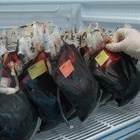 Golongan Darah A Rentan Infeksi Perut