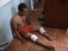 Eks Pimpinan Geng Motor Brigez Ditembak di Garut