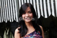 Chelsea terlihat semakin manis dengan gigi kelincinya. Gusmun/detikcom.