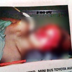 Foto Autopsi Istri Saipul Jamil Beredar di Internet?