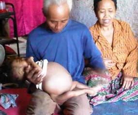 Balita 9 Bulan Berjuang Melawan Kanker Usus