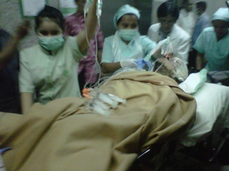  WN Belanda Bakar Diri Dijenguk Kakaknya