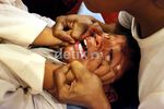 Balita Pun Ikut Sunatan Massal