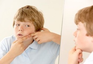 Jerawatan Bikin Remaja Jadi Gampang Emosional
