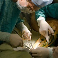 Vasektomi & Tubektomi Paling Tepat Buat Orang Indonesia