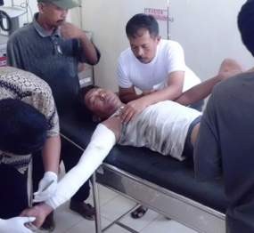 Peralatan Las Meledak, Tangan & Kaki Honorer Pemkab Terbakar