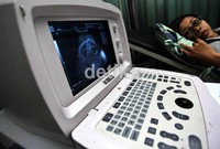 Seorang ibu hamil saat memeriksa kandungannya dengan USG (Ultra Sonography) di Rumah Zakat, Pulo Asem Timur, Jakarta.