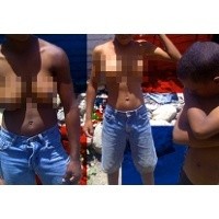 Bertubuh Pria, Berpayudara Wanita Karena Gangguan Genetik