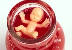 Negara yang Sangat Membolehkan dan Tidak Membolehkan Aborsi Negara yang Sangat Membolehkan dan Tidak Membolehkan Aborsi
